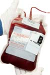 گزارش عوارض انتقال خون ناشی از خطای انسانی در دو بیمار تالاسمی