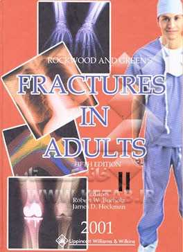 Rochwood and wilkins:  fractures in adults