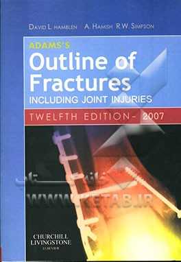 Adams's outline of fractures including joint injuries 2007