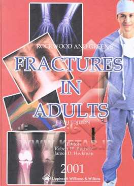 Rockwood and green's:  fracturess in adult