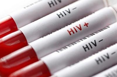 شناسایی ۲۳۰۰۰ مبتلا به HIV در ایران