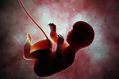 علوم پزشکی: از بین 500 هزار سقط جنین تنها 10 هزار سقط قانونی بوده است