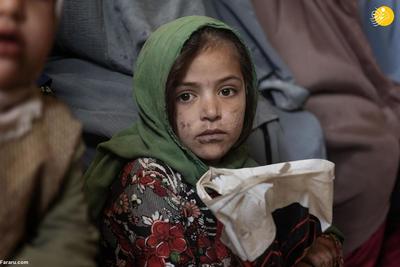 (ویدئو) بدتر شدن سوءتغذیه کودکان افغان در حکومت طالبان