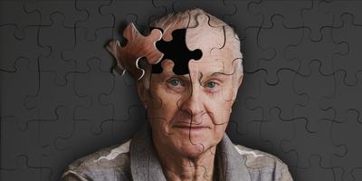 مهمترین علل آلزایمر چیست؟