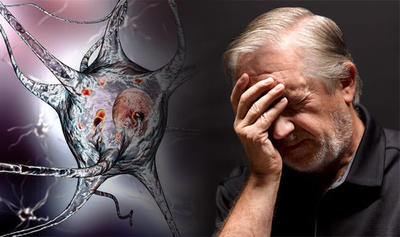 آلزایمر بیشتر در افراد بالای ۶۵ سال دیده می شود