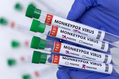کدام واکسن‌ها می‌توانند مکانیزم دفاعی علیه آبله میمون داشته باشند؟