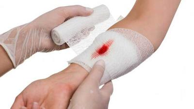 راهکارهای درمان انواع زخم در خانه