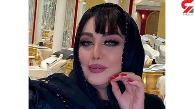 این خانم بازیگر رکورددار جراحی زیبایی ایرانی ! + عکس های افشاگر !