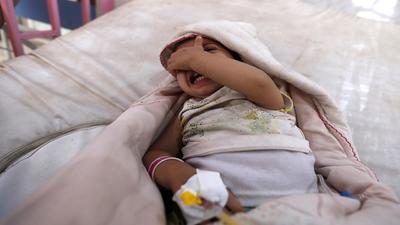 محاصره‌کنندگان آمریکایی-سعودی جان یک کودک مریض یمنی را گرفتند+ تصاویر