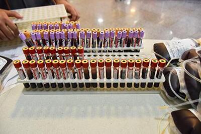 انجام آزمایش ملکولی بسیار پیشرفته NAT در انتقال خون استان تهران برای اولین بار