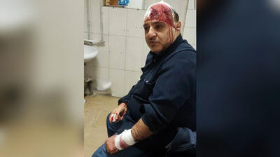 حمله به یک فدراسیون با چاقو و قمه /  مسئولی که به‌خاطر مبارزه با تقلب، خونین و مجروح شد +عکس