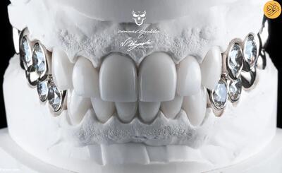 (تصاویر) دندانپزشکی که خنده‌های میلیون دلاری خلق می‌کند