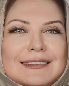 چهره لعیا زنگنه بعد از جراحی زیبایی (عکس)