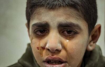 اشک‌های پسر کوچک فلسطینی که از زیر آوار حمله اسرائیل نجات داده شد + عکس