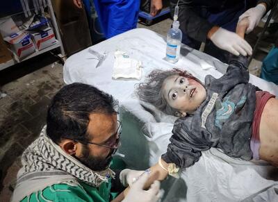 جدیدترین آمار شهدا و مجروحان ناشی از حمله های اشغالگران به غزه