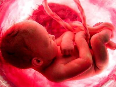 خون بند ناف نوزاد در این بیماری ها معجزه می‌کند