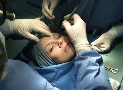 سالانه ۳۲۰ هزار جراحی برای زیبایی: چهره اصیل ایرانی در حال تحریف است