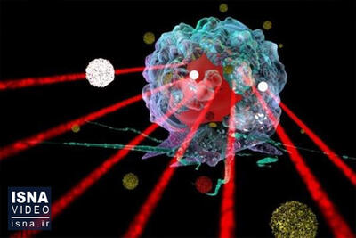 ویدیو/ فناوری لیزر به کمک درمان سلول‌های سرطانی می‌آید