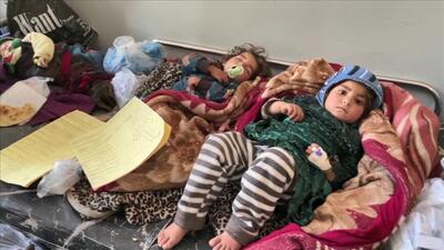شیوع سرخک در افغانستان