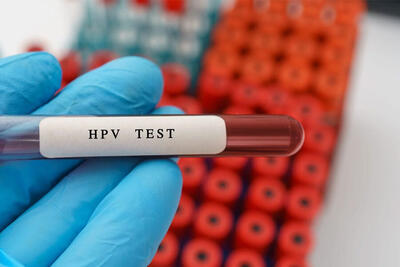 از چه سنی آزمایش های اچ پی وی را انجام دهیم؟