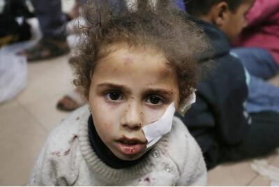 جنایت علیه بشریت در ۱۵۰ روز؛ رژیم صهیونیستی ۷ هزار برابر هر جنگی کودکان غزه را می‌کشد