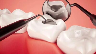 تولید مایعی که از پوسیدگی دندان جلوگیری می کند