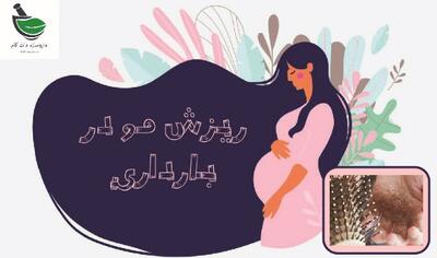 علت ریزش مو در بارداری و راه های پیشگیری از آن - روزنامه رسالت