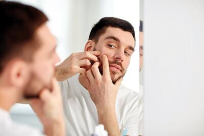 ۱۰ راهکار مؤثر برای از بین بردن جوش‌های صورت
