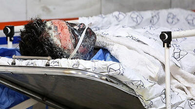 346 کشته و زخمی در حوادث چهارشنبه‌ سوری تا امروز / 28 نفر قطع عضو شدند + جزییات