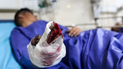 حوادث تلخ چهارشنبه‌ سوری / 405 نفر دچار آسیب چشمی شدند