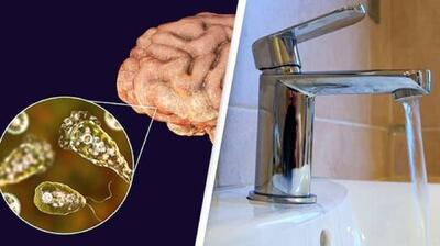 شست‌وشوی بینی با آب شیر ممکن است به عفونت آمیبی مغزخوار منجر شود | رویداد24