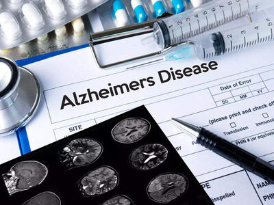 تست‌های مهم برای تشخیص زودهنگام آلزایمر