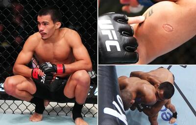 مبارز برزیلی به خاطر گاز گرفتن حریف در اولین مبارزه خود از UFC کنار گذاشته شد | پایگاه خبری تحلیلی انصاف نیوز