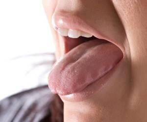 خال این رنگی داخل دهان یعنی سرطان زبان !