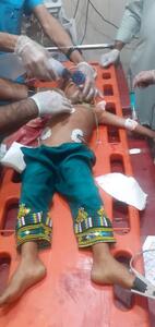 تصویر دلخراش کودک بلوچ مصدوم شده در حمله تروریستی | اقتصاد24