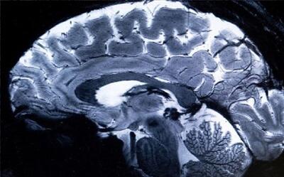 اسکن تصاویر مغز انسان توسط قدرتمندترین  ام‌ آر آی  جهان