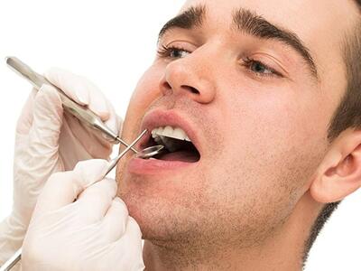 درمان پوسیدگی دندان در منزل با طب سنتی + روش توقف پوسیدگی دندان