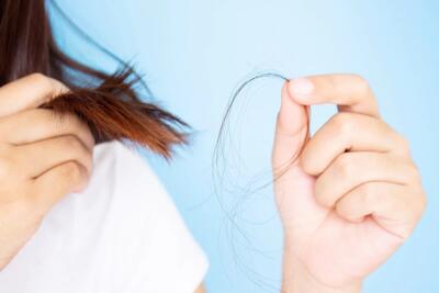 آیا کم‌ خونی باعث ریزش مو می شود ؟