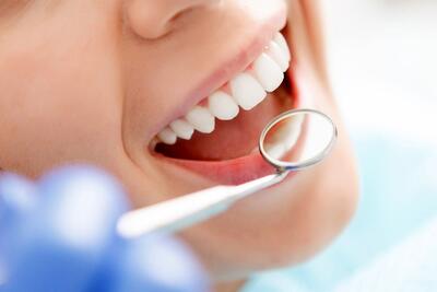 ایران ۴۵ هزار دندانپزشک دارد/ ۱۱ استان سرانه‌ای بالاتر از میانگین سرانه دندانپزشک دارند