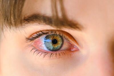 پلک‌زدن در واقع بینایی ما را تقویت می‌کند - زومیت