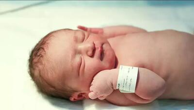 عکس/ زیباترین نوزاد عجیب الخلقه جهان به دنیا آمد!