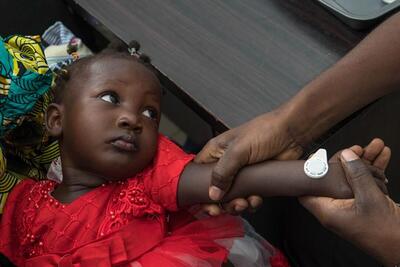ساخت واکسن بدون درد سرخک و سرخجه برای کودکان