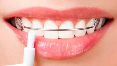 ارتودنسی ثابت و ارتودنسی متحرک: مقایسه دو روش درمانی برای اصلاح انحراف دندان‌ها
