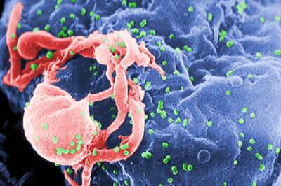 ببینید علائم ویروس HIV چیست | ویروس HIV این روزها خیلی شایع شده است