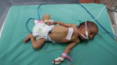 شهادت نوزاد نجات یافته از شکم مادر شهید + فیلم
