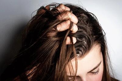 نکاتی برای خلاصی از چربی مو و دردسرهایش | اقتصاد24