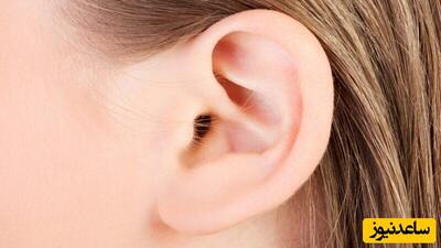 موی روی لاله گوش نشانه چه بیماری است؟