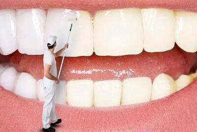 ترفندی ساده و طلایی برای سفید کردن دندان ها در خانه
