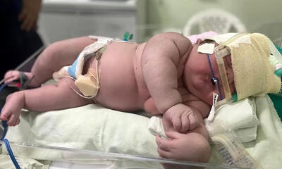 سنگین‌ترین نوزاد کشور متولد شد
