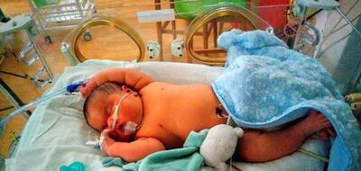 تولد نوزاد شش کیلوگرمی در میاندوآب